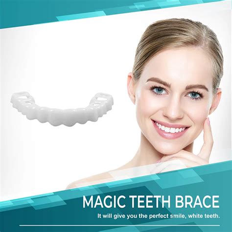 How magic teeth braces can boost your self-esteem with a perfect smile